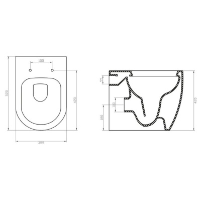 Приставной унитаз BelBagno Marino [BB105CB + BB105SC] с сиденьем фотография